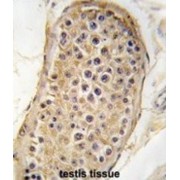 Rapamycin-Insensitive Companion of mTOR (RICTOR) Antibody