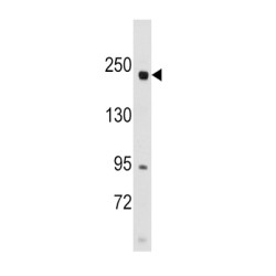 Rapamycin-Insensitive Companion of mTOR (RICTOR) Antibody