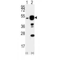 Eukaryotic Translation Initiation Factor 4A1 (EIF4A1) Antibody