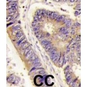 PDZ Protein Interacting Specifically With TC10 (PIST) Antibody