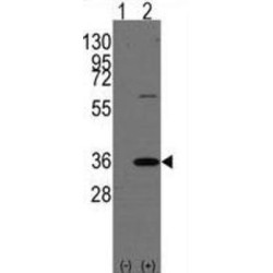 REA Antibody