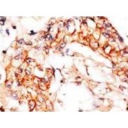 NEDD8 Activating Enzyme E1 Subunit 1 (NAE1) Antibody