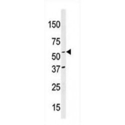 NEDD8 Activating Enzyme E1 Subunit 1 (NAE1) Antibody