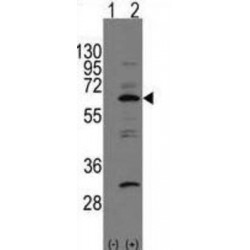 NEDD8 Activating Enzyme E1 Subunit 1 (NAE1) Antibody