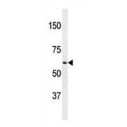 Amyloid Protein-Binding Protein 2 (APPBP2) Antibody