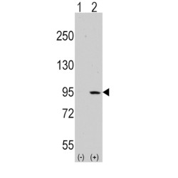 Epithelial Discoidin Domain-Containing Receptor 1 (DDR1) Antibody