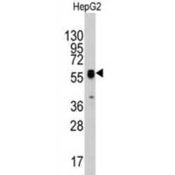 ECGF1 Antibody