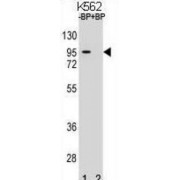 Regulator Of MON1-CCZ1 (RMC1) Antibody