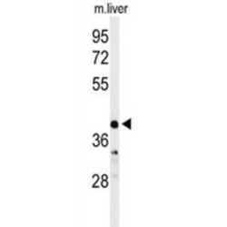 Carbonic Anhydrase VB, Mitochondrial (CA5B) Antibody