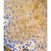 Keratin, Type I Cytoskeletal 9 (KRT9) Antibody