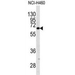 Keratin, Type I Cytoskeletal 9 (KRT9) Antibody