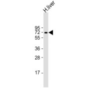 WB analysis of human liver tissue. Calculated MW: 48 kDa. Blocking/Dilution buffer: 5% NFDM/TBST.