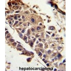 Pigment Epithelium-Derived Factor / PEDF (SERPINF1) Antibody