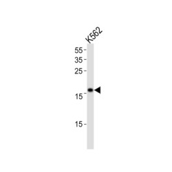 DNA Polymerase Epsilon 3, Accessory Subunit (POLE3) Antibody