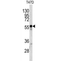 Alpha-1-B Glycoprotein (A1BG) Antibody