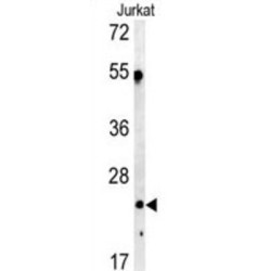 Complement Component 1q Subcomponent A (C1qA) Antibody