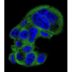 Fibrinogen Gamma (FGG) Antibody