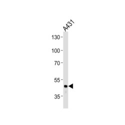 Fibrinogen Gamma (FGG) Antibody