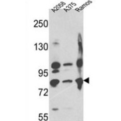 Neprilysin / NEP (MME) Antibody