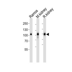 Neprilysin / NEP (MME) Antibody