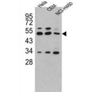 Carboxypeptidase A4 (CPA4) Antibody