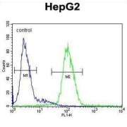 Ceruloplasmin (CP) Antibody