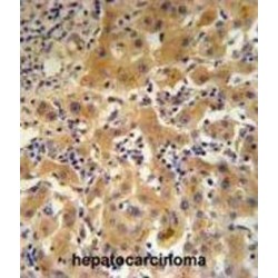 Ceruloplasmin (CP) Antibody