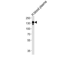 Ceruloplasmin (CP) Antibody