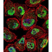 Krueppel-Like Factor 5 (KLF5) Antibody