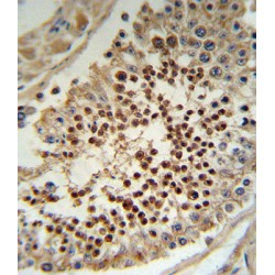 Krueppel-Like Factor 5 (KLF5) Antibody