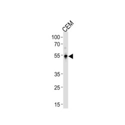 Krueppel-Like Factor 5 (KLF5) Antibody