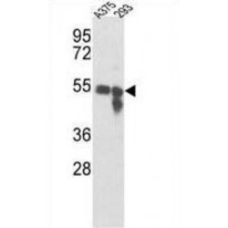 Tyrosinase (TYR) Antibody