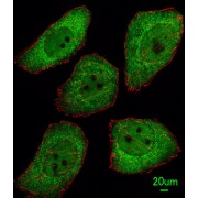 Pituitary Tumor Transforming 1 (PTTG1) Antibody