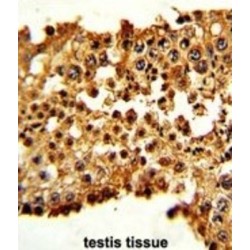 Pituitary Tumor Transforming 1 (PTTG1) Antibody