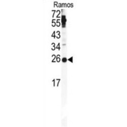 Pituitary Tumor Transforming 1 (PTTG1) Antibody