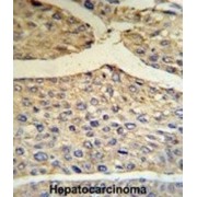 Complement Factor B (BF) Antibody