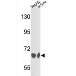 Complement Factor B (BF) Antibody