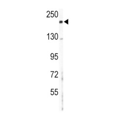 Collagen Type V Alpha 2 (COL5A2) Antibody