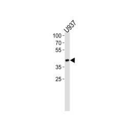 Apolipoprotein L (APOL1) Antibody