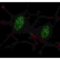 Mothers Against Decapentaplegic Homolog 2 (SMAD2) Antibody