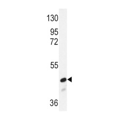 Mothers Against Decapentaplegic Homolog 2 (SMAD2) Antibody