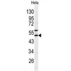 Serpin H1 (SERPINH1) Antibody