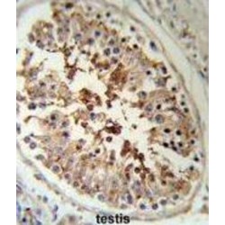 Serpin H1 (SERPINH1) Antibody