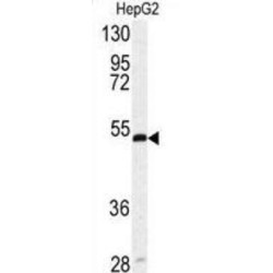 Serpin H1 (SERPINH1) Antibody