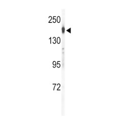 Collagen Type IV Alpha 1 (COL4A1) Antibody