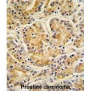 MOB Kinase Activator 1A (MOBKL1B) Antibody