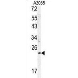 MOB Kinase Activator 1A (MOBKL1B) Antibody