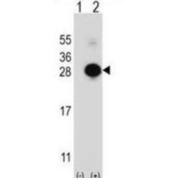 MOB Kinase Activator 1A (MOBKL1B) Antibody