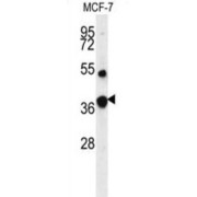 Fructose-1,6-Bisphosphatase 1 (FBP1) Antibody