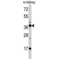 Fructose-1,6-Bisphosphatase 1 (FBP1) Antibody